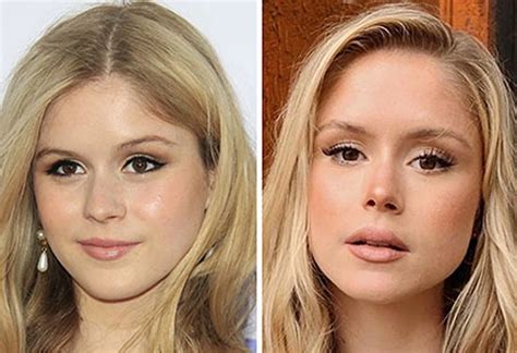 Erin Moriarty Before and After Plastic Surgery Journey。